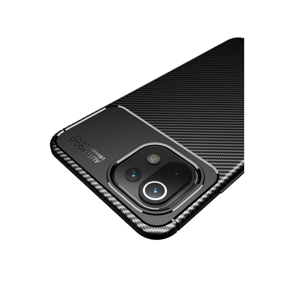 Xiaomi Mi 11 Lite Kılıf Auto Focus Karbon Kapak - Siyah
